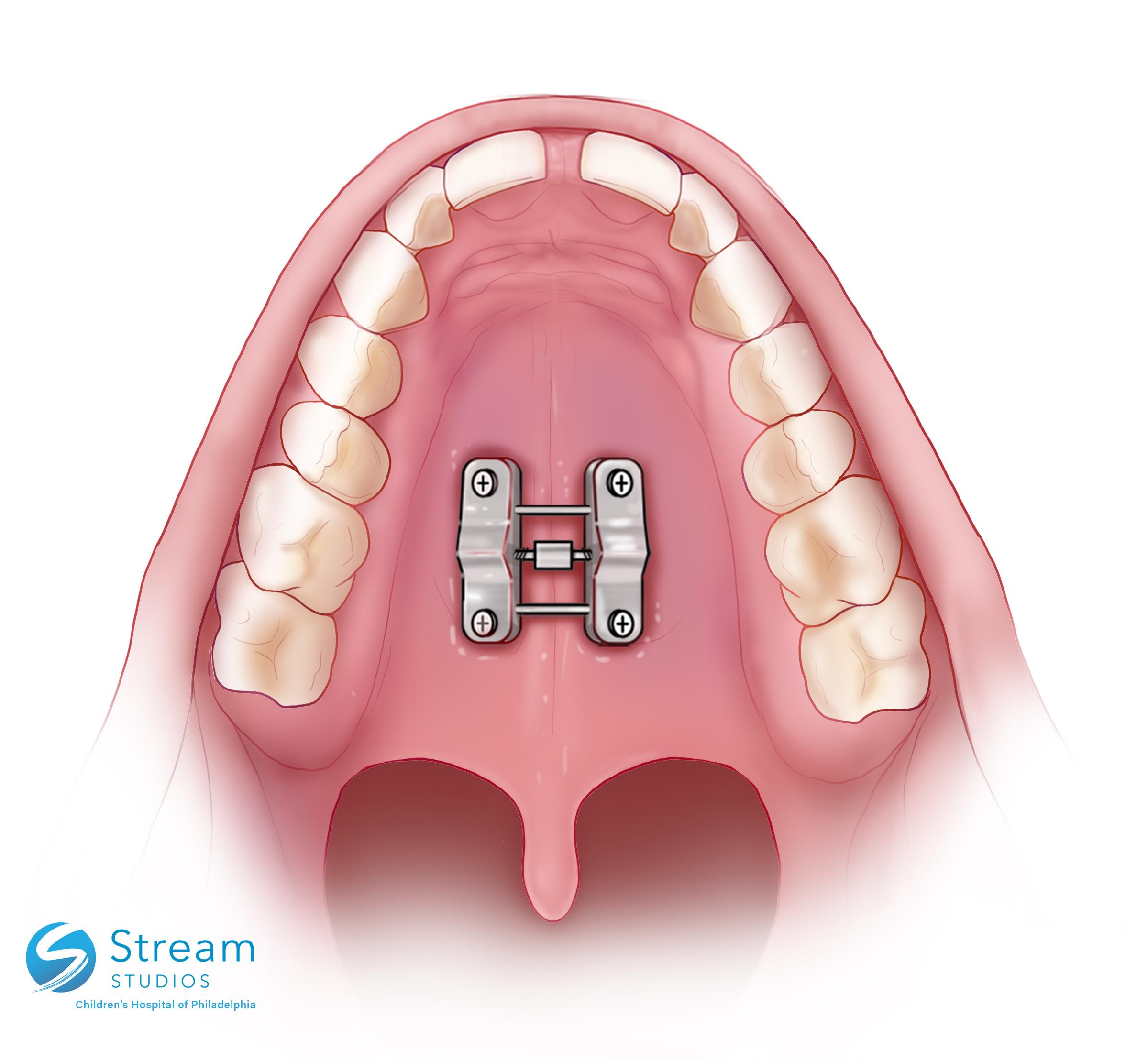 animated jaw with an expander